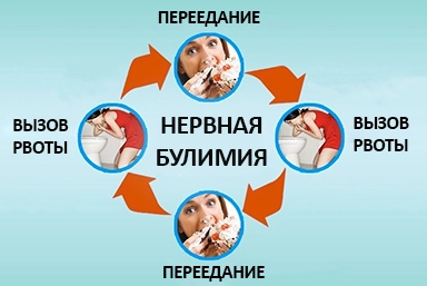 Лечение булимии в Мильково